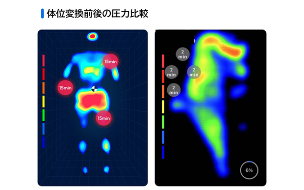 リアルタイムに体圧分布を可視化で褥瘡(じょくそう)予防